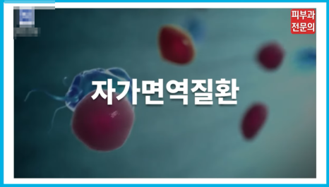 양평역피부과 추천, 건선 그대로 두면 안 되는 이유 관련 이미지 3