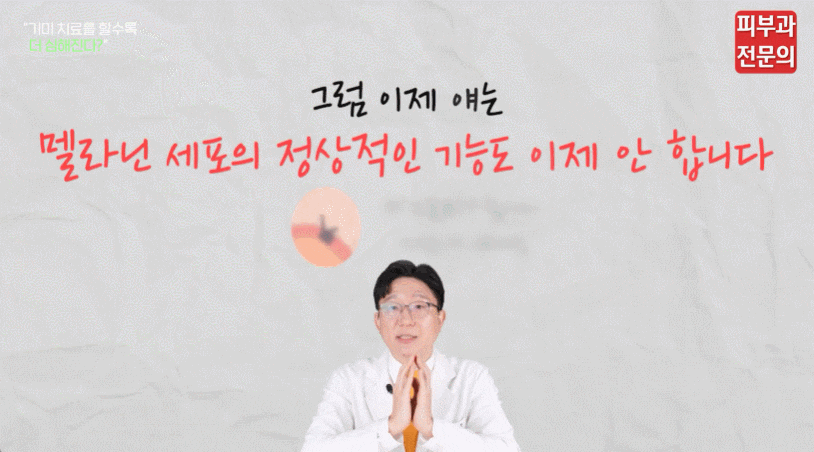 기미레이저치료 부작용 피부과 전문의가 정리해드립니다. 관련 이미지 4