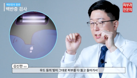 영등포구청역피부과 백반증 환자분들께 드리는 말씀 관련 이미지 5