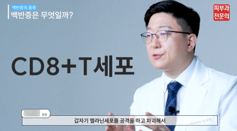 백반증바르는약 치료, 피부과에서 가장 중요하게 생각하는 1가지 관련 이미지 3