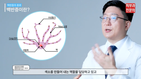샛강역피부과 백반증에도 종류가 있다? <대공개> 관련 이미지 2