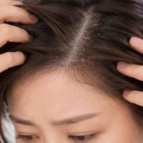 영등포역피부과 지루성피부염 치료, 계절이 바뀔 때마다 붉은기와 각질이 심해지는 이유는? 관련 이미지 5