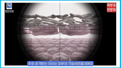 서울건선치료 병원, 피부과 전문의가 꼭 드리고 싶은 말씀 관련 이미지 4