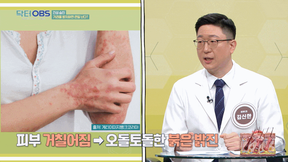 양평역 피부과, 계피부과 김신한 병원장 방송 출연 (OBS 경인TV ‘닥터OBS’) 관련 이미지 4