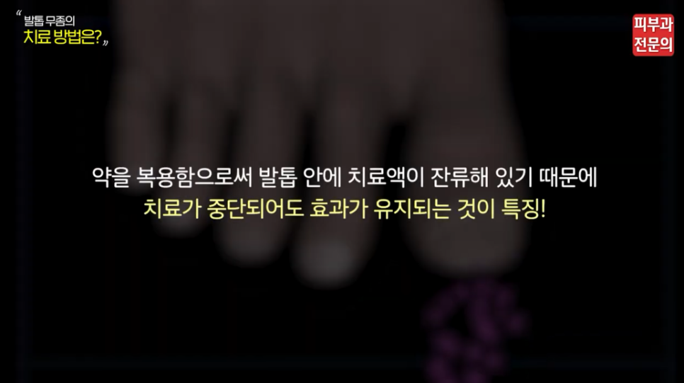 노량진역피부과 추천? 전문의가 말하는 발톱무좀 없애는 법 TOP3? 관련 이미지 3