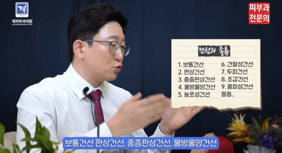 엑시머레이저치료 병원 건선, 제때 잡지 않으면 안 됩니다. 관련 이미지 4