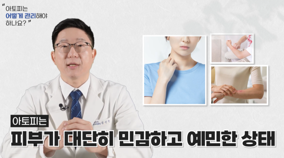 아토피스테로이드 치료 방법? 피부과 전문의가 정리해 드립니다. 관련 이미지 3
