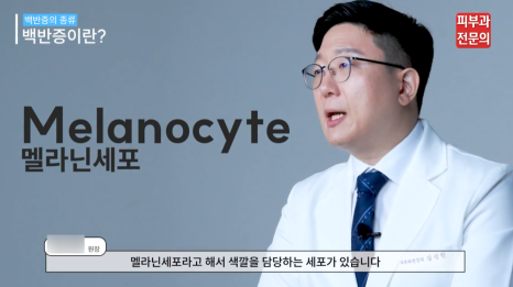 백반증엑시머 레이저 치료 전 꼭 알고 계셔야 할 핵심 정보 관련 이미지 2