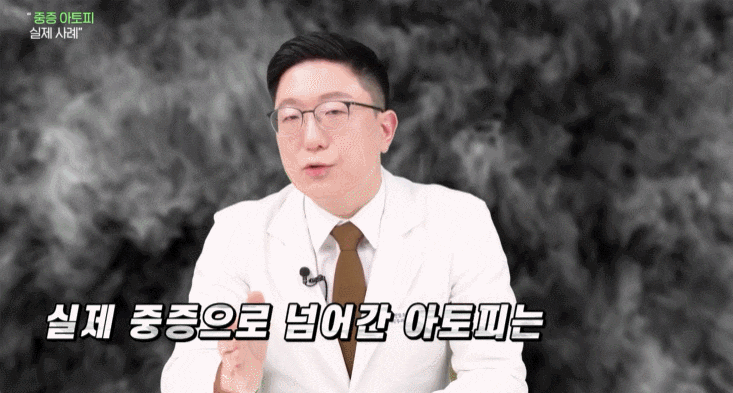 보라매역피부과 아토피 증상, 연고 치료와 함께 필요한 필요한 피부 관리 안내 관련 이미지 3