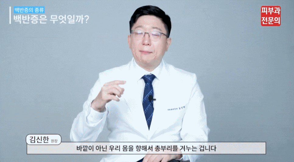 백반증 초기에 알아두면 좋은 증상 특징과 관리 포인트 관련 이미지 3