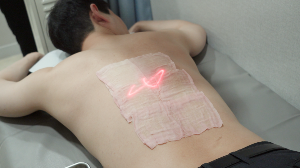 영등포구청역피부과 추천 백반증 증상에 따른 3가지 치료 방법에 관한 정보! 관련 이미지 3