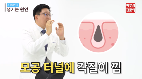 서울 여드름치료병원 안전한 치료를 위해 꼭 기억하셔야 할 것 관련 이미지 3