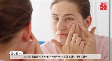 성인여드름치료 병원 압출 치료부터 레이저 치료까지 정리해 드립니다. 관련 이미지 3