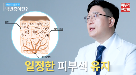 피부백반증치료 방법, 이것만 꼭 살펴보세요. 관련 이미지 3