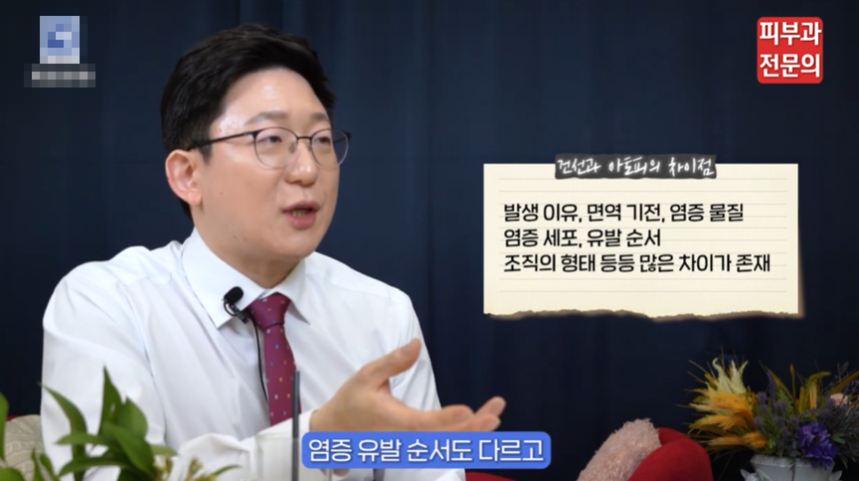 양평역피부과 추천, 건선 그대로 두면 안 되는 이유 관련 이미지 5
