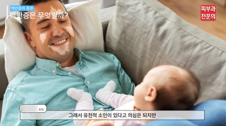 백반증치료방법 엑시머 레이저 장점과 기대 효과는? <총정리> 관련 이미지 6