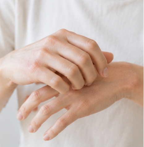 샛강역피부과 아토피 증상, 반복해서 긁는 부위가 두꺼워지고 거칠어진다면? 관련 이미지 2