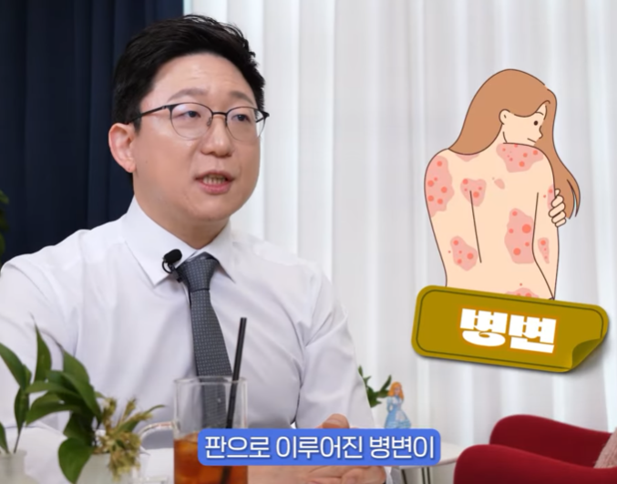 영등포건선 치료, 재발 방지를 위해 기억해야 할 핵심 관련 이미지 5