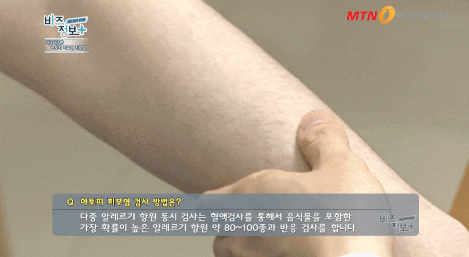 영등포구피부과 전문의가 말씀드리는 아토피샤워 방법 관련 이미지 4