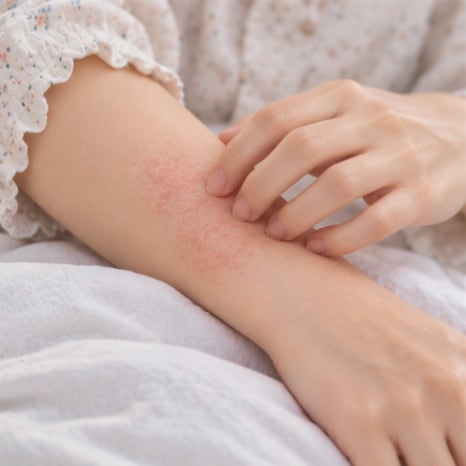 노들역피부과 아토피 증상, 자다가 무의식적으로 피부를 긁는다면 치료가 필요할까요? 관련 이미지 3