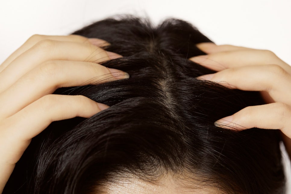 영등포 탈모치료피부과 전문의는 &lsquo;이것&rsquo; 부터 한다? 관련 이미지 3