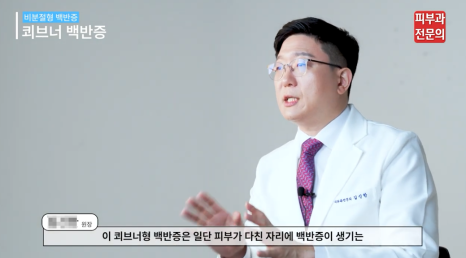 백반증약 처방 병원, 면역억제연고 치료에 대한 정보 관련 이미지 5