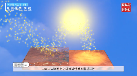 오목교역피부과 백반증 증상, 초기에 살펴봐야 할 변화 관련 이미지 6