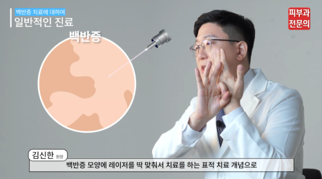 피부흰색반점 치료 백반증? 피부과 전문의가 말하는 핵심 관련 이미지 6