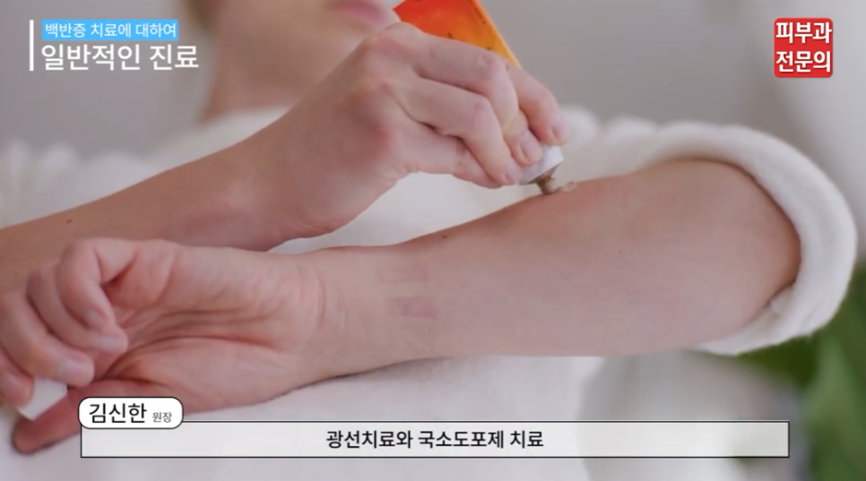 피부 백반증연고 치료, 면역 체계에 접근해야 하는 이유! 관련 이미지 11