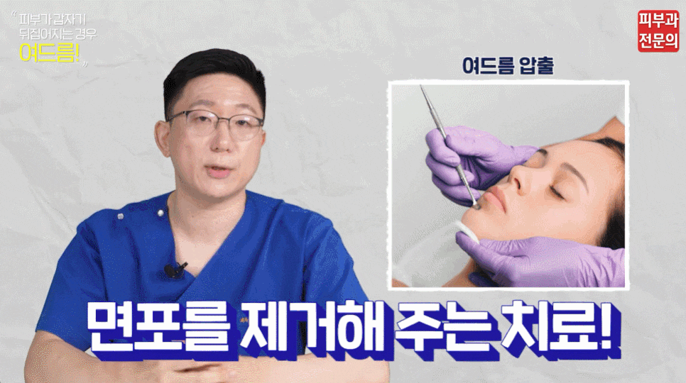 10대여드름 치료 피부과? 염증 주사 치료 전 꼭 알아 두셔야 할 것! 관련 이미지 4