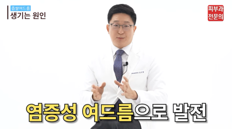 염증성여드름치료 피부과, 관리에 힘써야 하는 이유? 관련 이미지 2