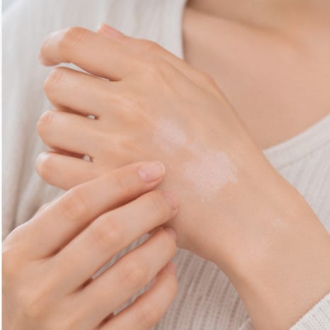 샛강역피부과 백반증 증상, 흰 반점의 경계가 점점 넓어지는 것 같다면 무엇을 확인해야 할까요? 관련 이미지 4