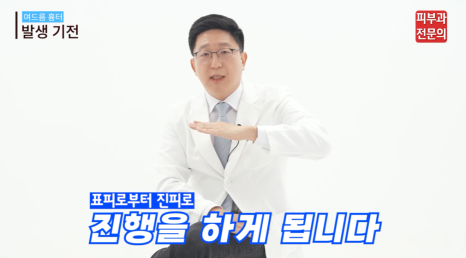 얼굴 여드름흉터치료피부과 추천? 똑똑하게 치료받는 방법 공개 관련 이미지 4