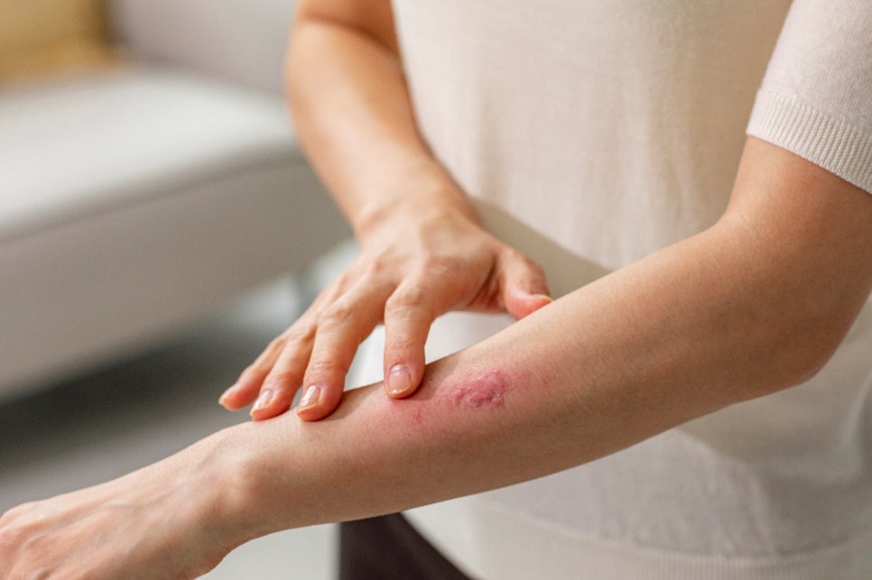 신풍역 아토피 피부과, 안전한 접근을 위해 꼭 기억하셔야 할 1가지 관련 이미지 1