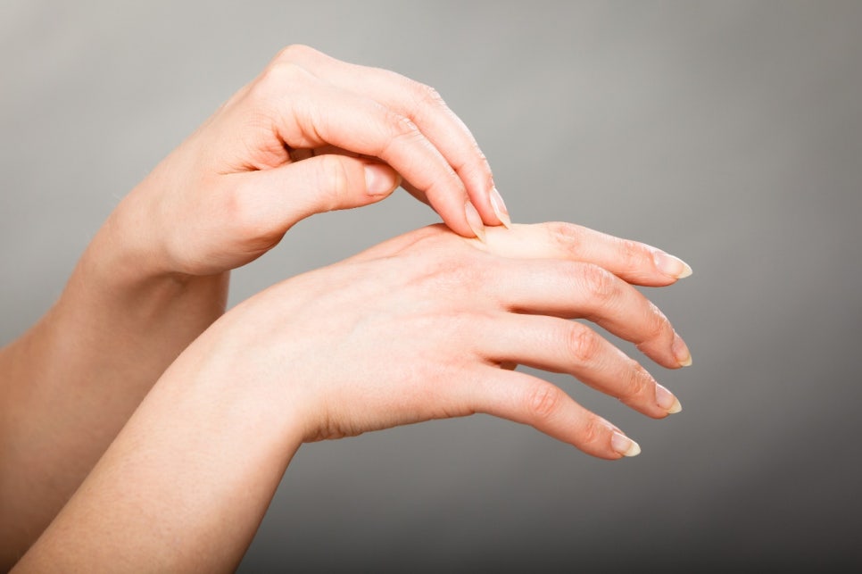 손가락/발바닥한포진치료에 있어서 가장 중요한 것? (문래역피부과추천) 관련 이미지 3