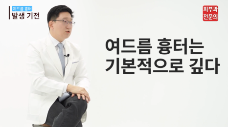 얼굴 여드름흉터치료피부과 추천? 똑똑하게 치료받는 방법 공개 관련 이미지 5