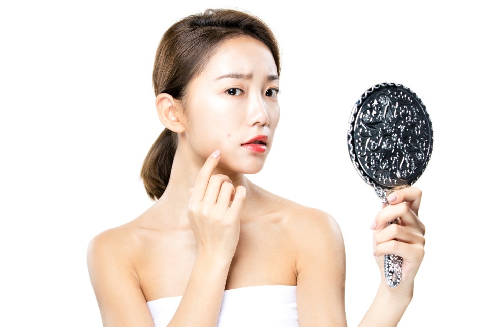 여드름흉터 증상에 따라 달라지는 레이저종류? (피부과 전문의 작성) 관련 이미지 1