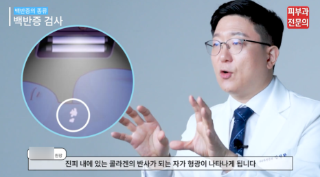 백반증바르는약 치료, 피부과에서 가장 중요하게 생각하는 1가지 관련 이미지 7