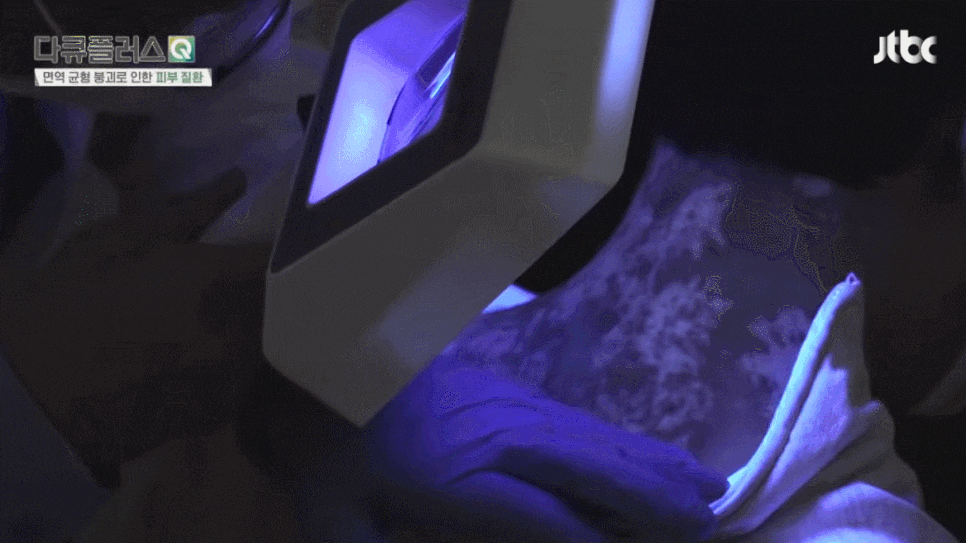 백반증 치료, 단순 색 변화가 아닌 피부 상태를 봐야 하는 이유 (JTBC다큐플러스) 관련 이미지 2