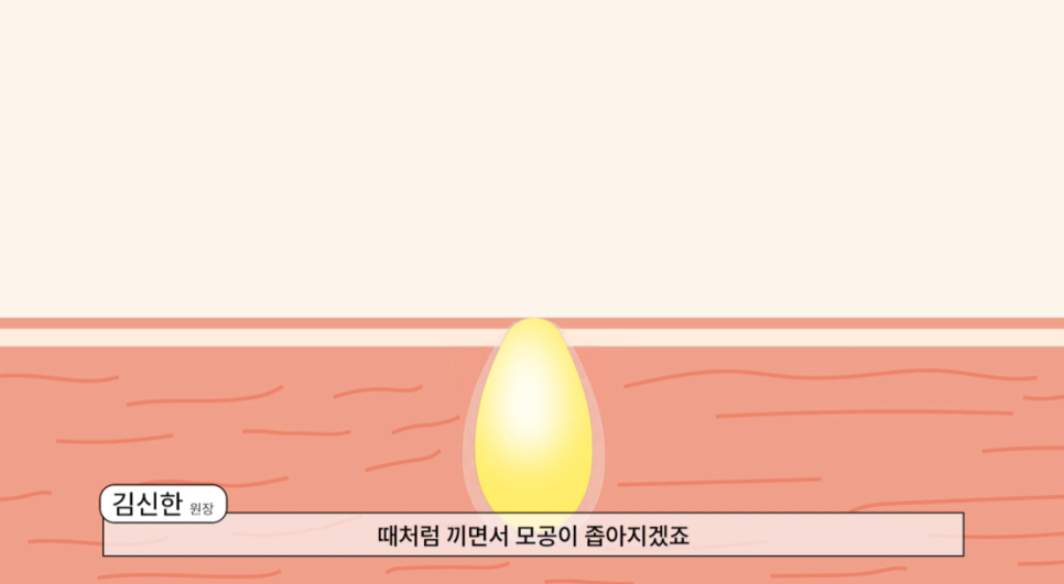 영등포 타임스퀘어피부과 여드름 세안 방법? 관련 이미지 4