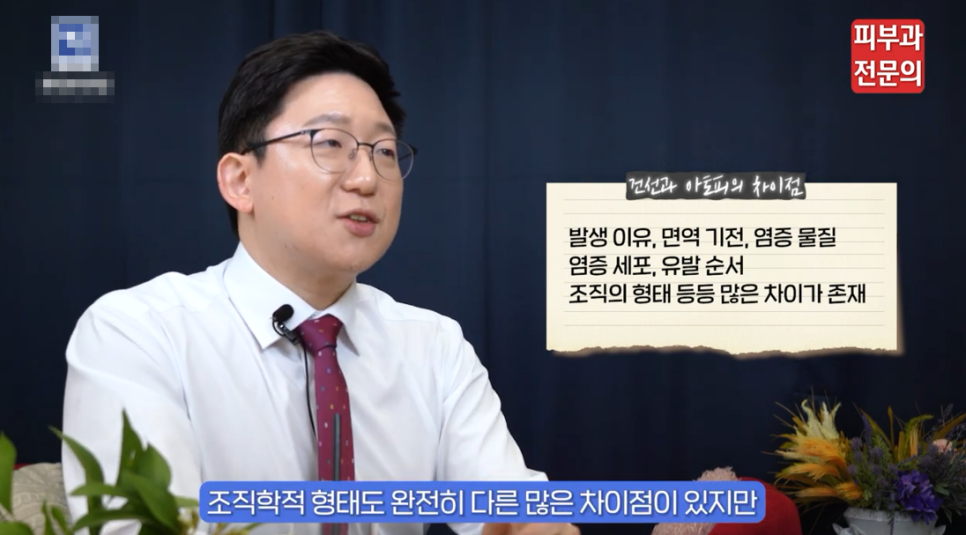 건선레이저치료 방법, 피부과 방문 전 꼭 읽어 보세요. 관련 이미지 3