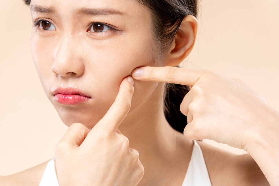 도림동피부과 추천 여드름 치료 A to Z : 피부 건강을 되찾고 싶다면? 관련 이미지 1