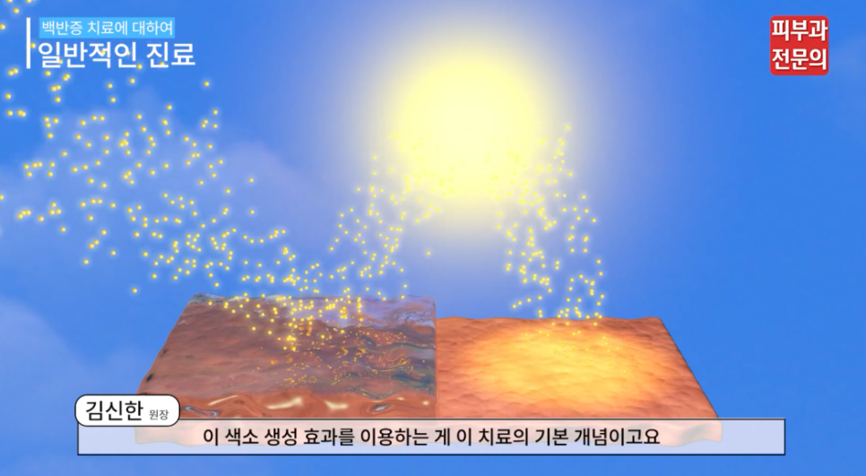 서울 백반증병원, 재발이 쉽다? 치료 후 관리법 관련 이미지 8