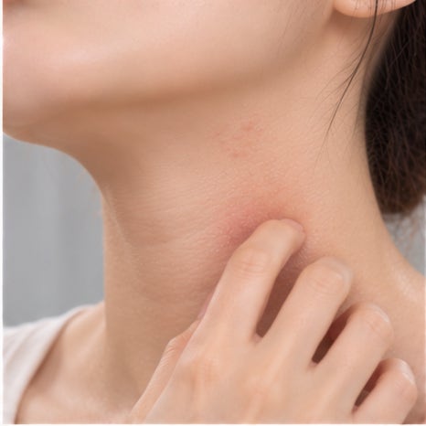 노들역피부과 아토피 증상, 자다가 무의식적으로 피부를 긁는다면 치료가 필요할까요? 관련 이미지 2