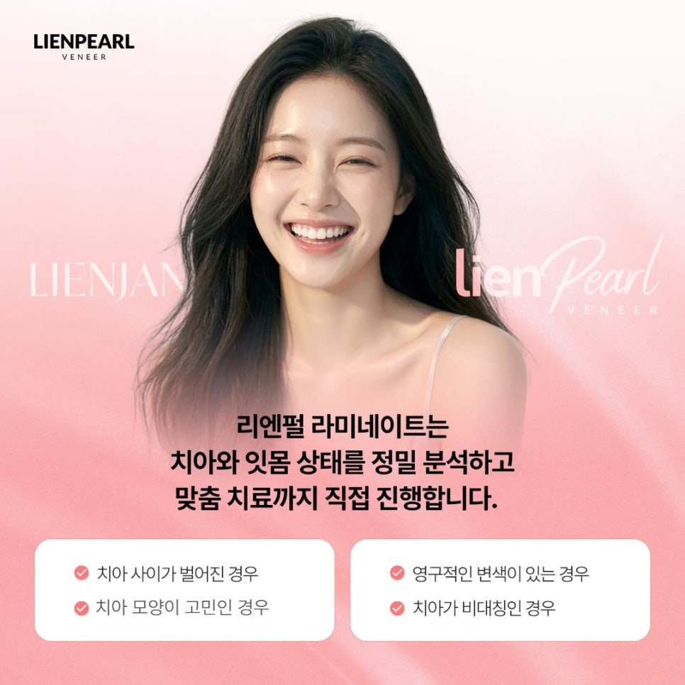 치과 라미네이트, 자연스러움은 디테일에서 시작됩니다 관련 이미지 3