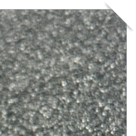 윗니 부분 교정 장단점 정리 관련 이미지 5