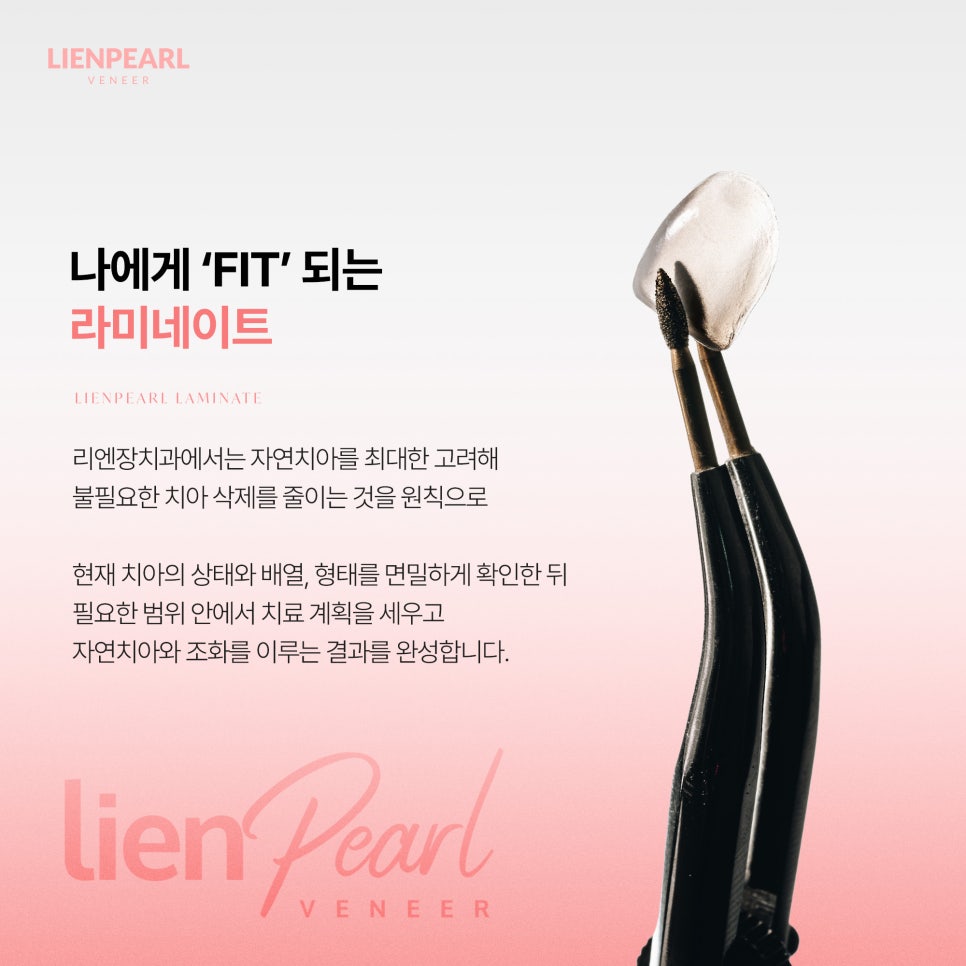 원데이 라미네이트, 하루 만에 자연스러운 결과도 가능할까요? 관련 이미지 6