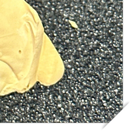 윗니 부분 교정 장단점 정리 관련 이미지 11