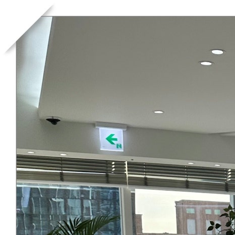 서울라미네이트 치료 과정 정리 관련 이미지 3