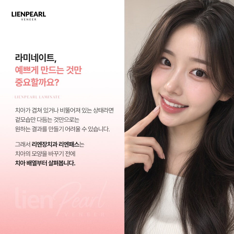 앞니 라미네이트 비용 고민된다면? 함께 확인해야 할 기준 관련 이미지 2